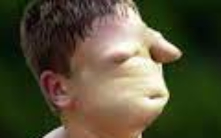 Zbiórka Operacja rąk dla goferka - zdjęcie główne