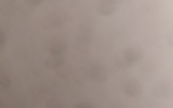 Zbiórka Na telefon Xiaomi - zdjęcie główne