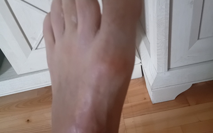 Zbiórka Sprawna noga - zdjęcie główne