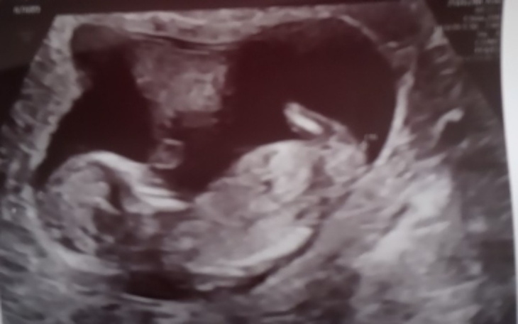 Zbiórka Sytuacja mieszkaniowa - zdjęcie główne