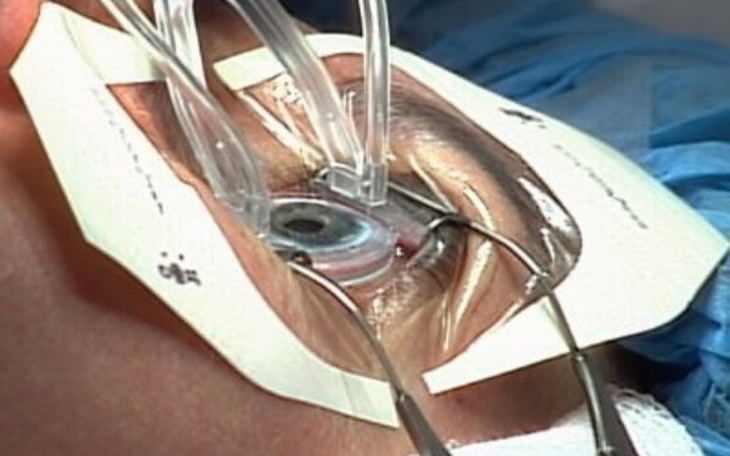 Zbiórka Na operacje oczu dla Mamy -24dpi - zdjęcie główne