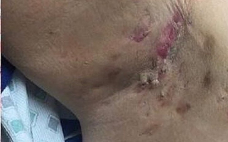 Zbiórka Pomóż mi nie cierpieć - zdjęcie główne