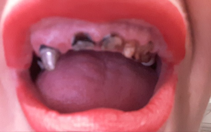 Zbiórka zdrowe zęby - zdjęcie główne