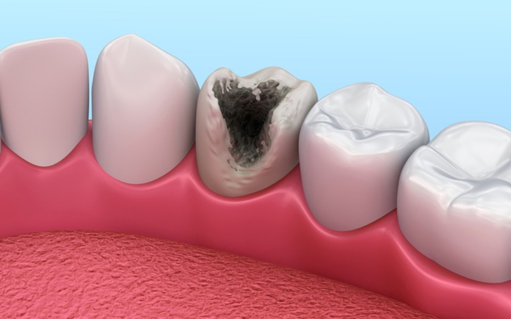 Zbiórka Bardzo potrzebne leczenie zębów - zdjęcie główne