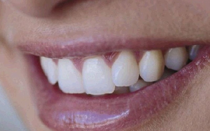 Zbiórka Sztuczna szczęka dla Pawla - zdjęcie główne