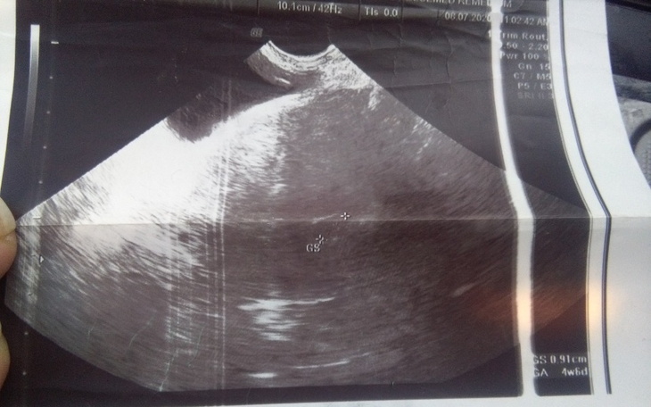 Zbiórka Ciężarna bez dachu nad głową - zdjęcie główne