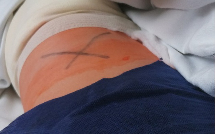 Zbiórka Na Rehabilitacja i sprzet - zdjęcie główne