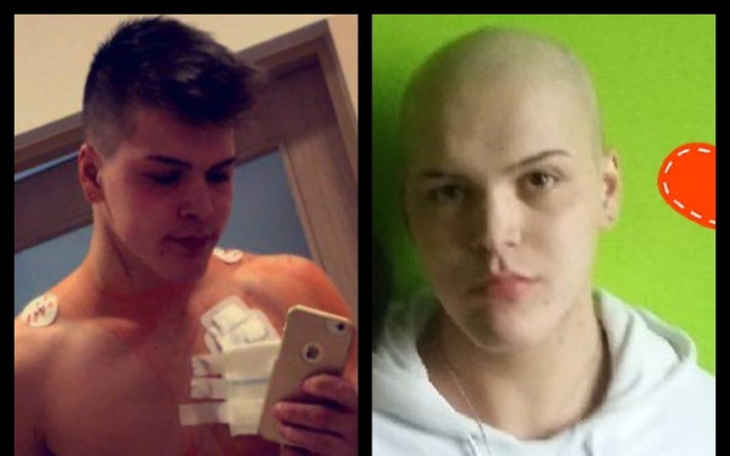 Zbiórka Pomoc Mateuszowi - zdjęcie główne