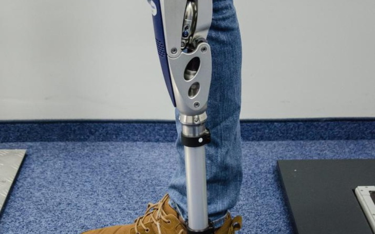 Zbiórka Proteza. Pomóż Spełnić Marzenia - zdjęcie główne