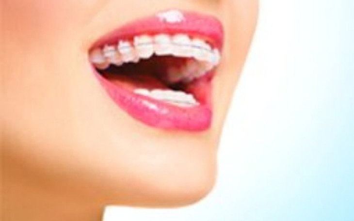 Zbiórka Na leczenie i aparat na zęby - zdjęcie główne