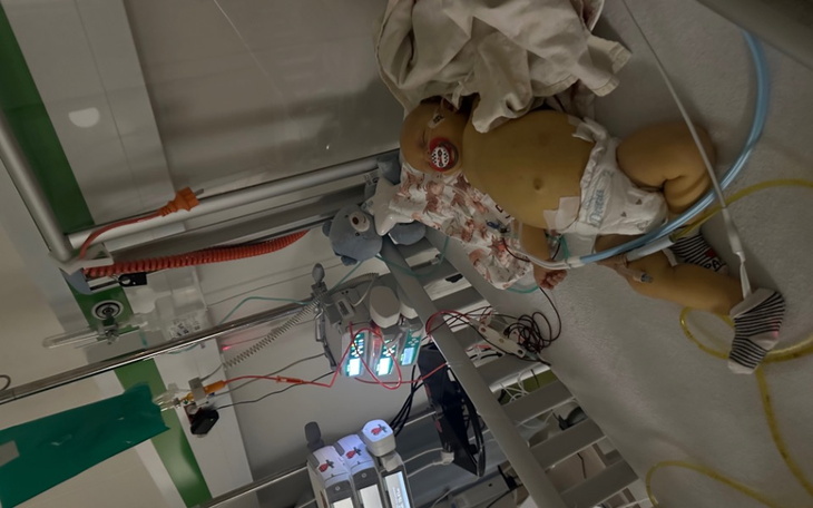 Dziecko w szpitalu, otoczone sprzętem medycznym.