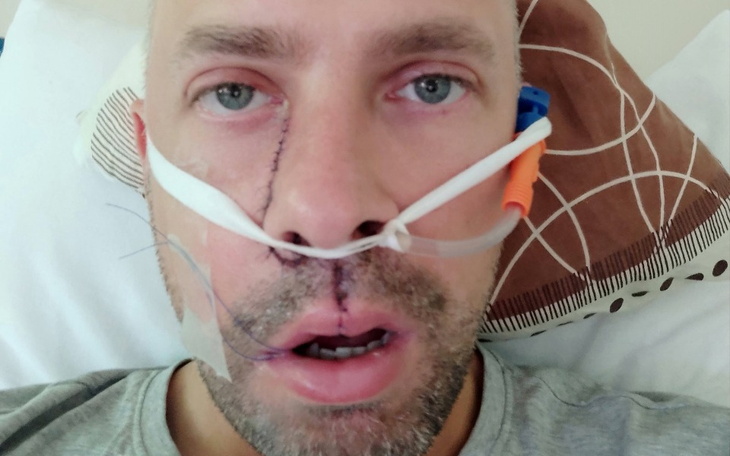 Zbiórka Rak Atakuje i to szybko ... - zdjęcie główne