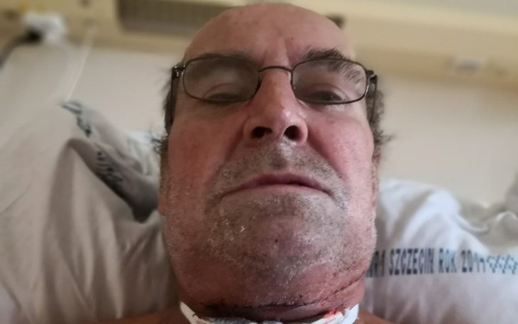 Zbiórka Zbieram na leczenie raka. - zdjęcie główne