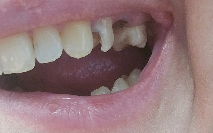 Zbiórka Zbiórka na leczenie uzębienia. - zdjęcie główne