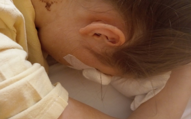 Dziewczyna leży na łóżku, zasłaniając twarz, z opatrunkiem na nosie.