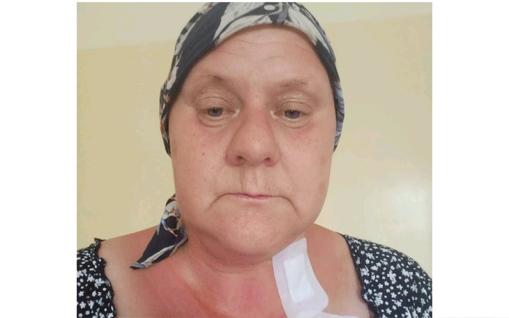 Zbiórka Proszę, pomóż uratować moją mamę - zdjęcie główne