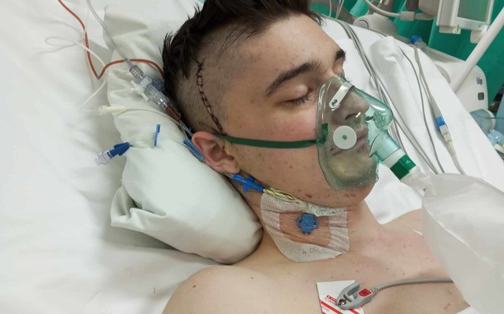 Młody mężczyzna w szpitalu, z maską tlenową.