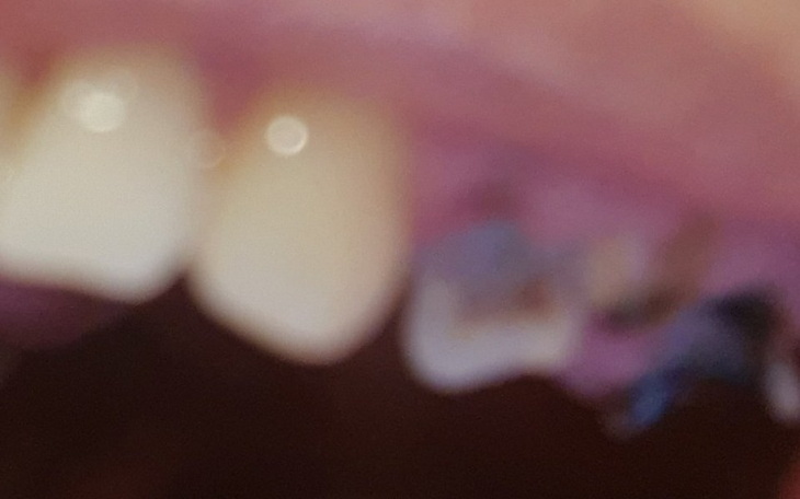 Zbiórka Nowe zęby, bo stare zawiodły - zdjęcie główne