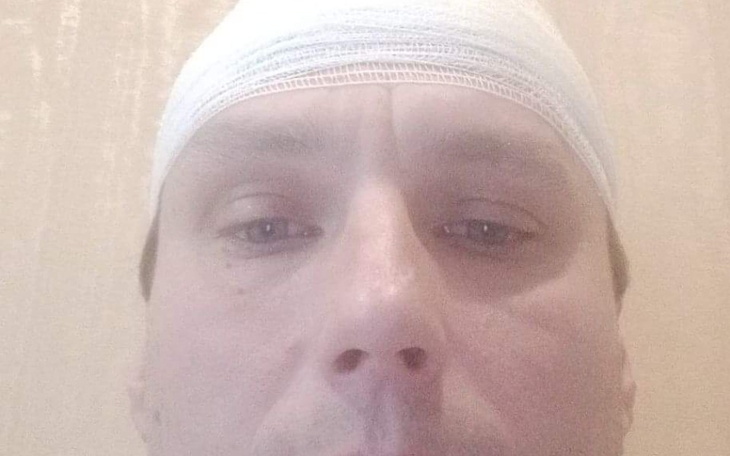 Mężczyzna z opatrunkiem na głowie, patrzący w kamerę.