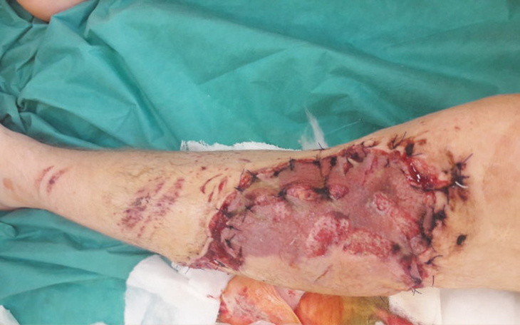 Zbiórka Pomoc chłopakowi po wypadku - zdjęcie główne