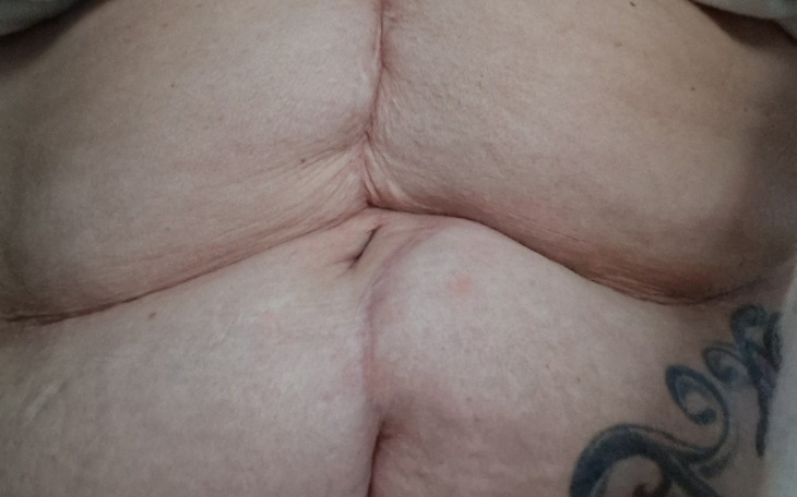 Zbliżenie na skórę z tatuażem, z widocznymi fałdami.