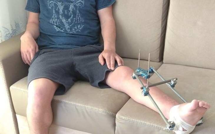 Zbiórka Piotra życie ze śrubami - zdjęcie główne