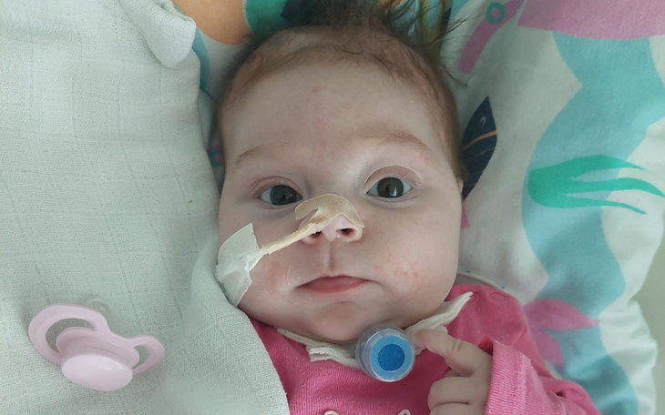 Mała dziewczynka z rurką nosową, patrzy w obiektyw.