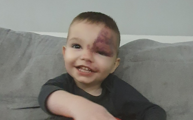 Zbiórka Leczenie i zabieg Kubusia - zdjęcie główne