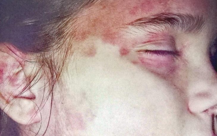 Zbiórka Na leczenie kochanej Lenki - zdjęcie główne