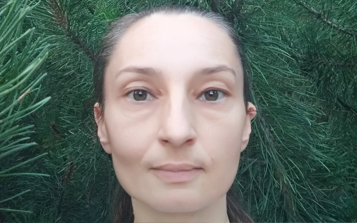 Kobieta z naturalnym makijażem stoi wśród zielonych drzew.