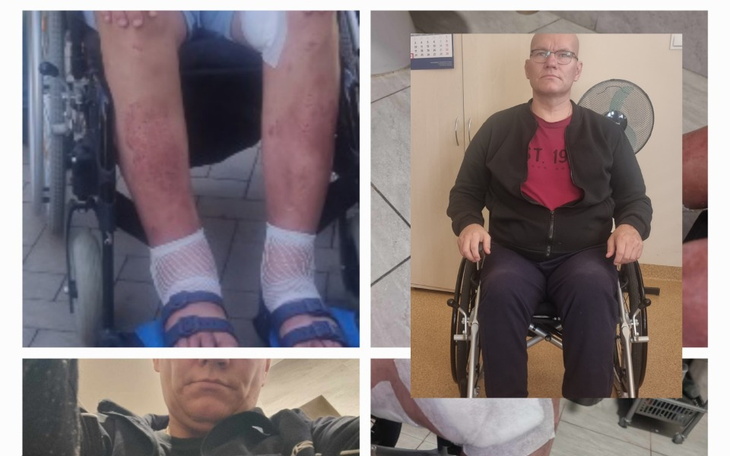 Zbiórka Zbiórka na leki i opatrunki. - zdjęcie główne