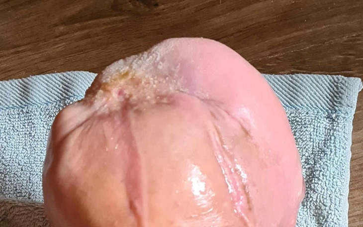 Widok na nietypowy obiekt, przypominający galaretowaty kształt.