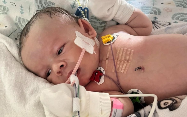 Noworodek z rurkami medycznymi, leżący w szpitalnym łóżku.