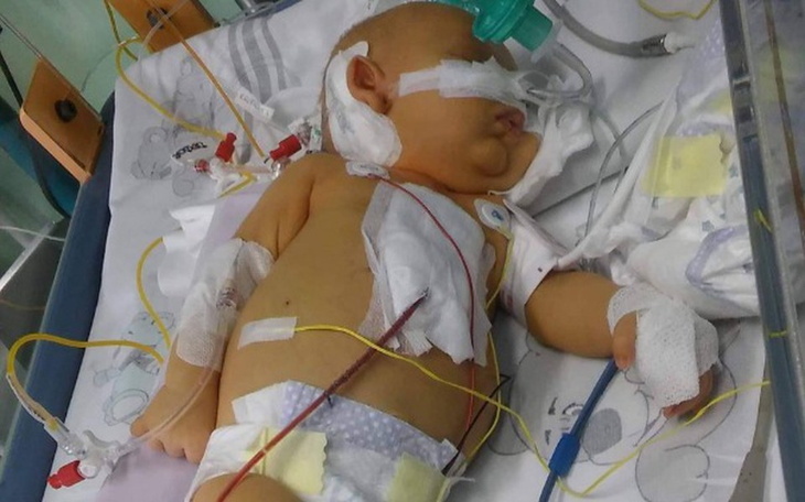 Zbiórka Pomóż Fabiankowi wrócić do domu - zdjęcie główne