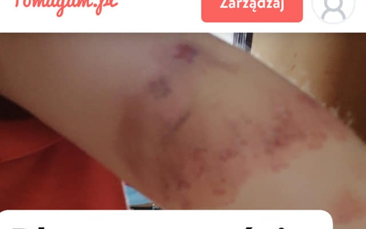 Zbiórka mam brata bardzo chorego - zdjęcie główne