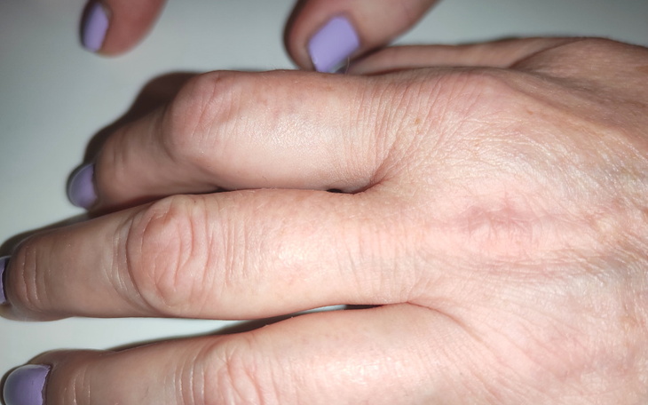 Zbiórka zycie z chorobą - zdjęcie główne