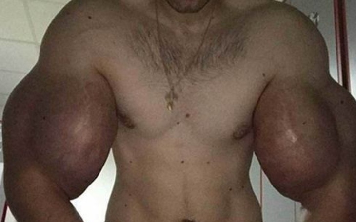 Zbiórka Paliak ty bogaty pomóż - zdjęcie główne