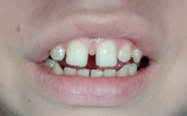 Zbiórka Zęby w kilka dni - zdjęcie główne