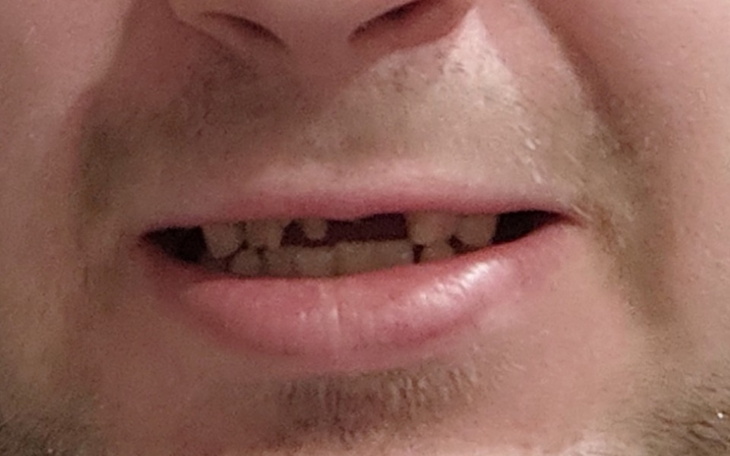 Zbiórka Na ratunek uśmiechu - zdjęcie główne