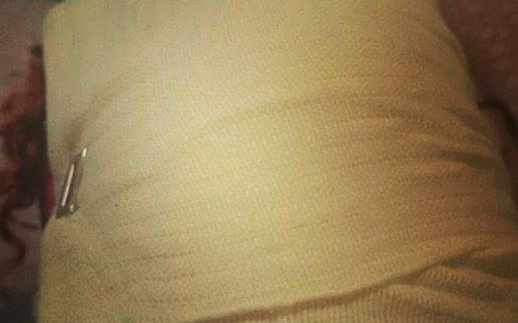 Zbiórka Leczenie Beaty - zdjęcie główne