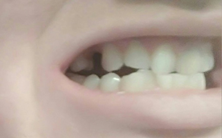 Zbiórka Pomóżmy Emilii odzyskać uśmiech! - zdjęcie główne