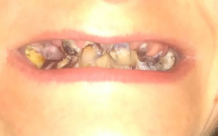 Zbiórka Na zabieg w narkozie - zdjęcie główne