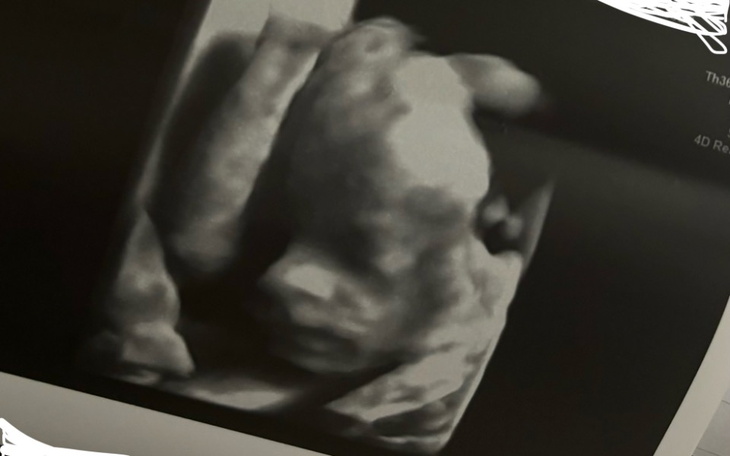 Zbiórka Lepszy początek nowego rozdziału - zdjęcie główne