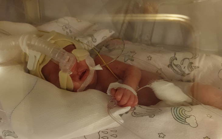 Noworodek w inkubatorze, z rurkami tlenowymi.
