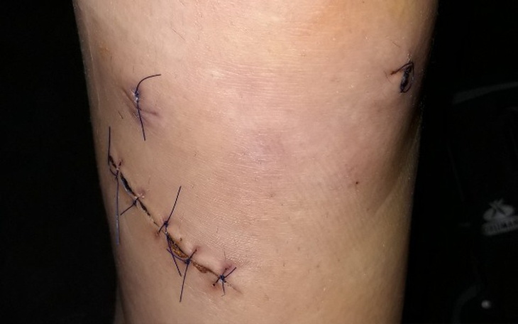 Zbiórka Leczenie kolana - zdjęcie główne