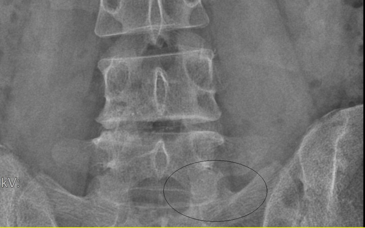 Zbiórka Skuteczna terapia bólu - zdjęcie główne