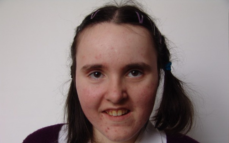 Zbiórka Nowy wózek i leczenie dla Karoli - zdjęcie główne