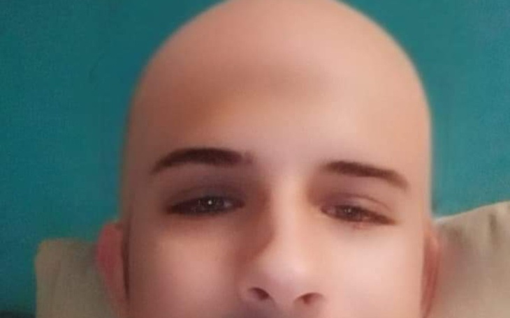 Zbiórka Na łysizne łysego - zdjęcie główne