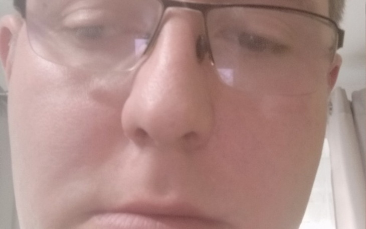 Zbiórka Na ratowanie nogi - zdjęcie główne