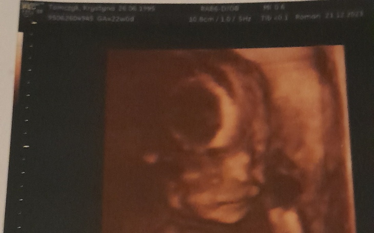 Zbiórka Pomoc przyszłej mamie - zdjęcie główne